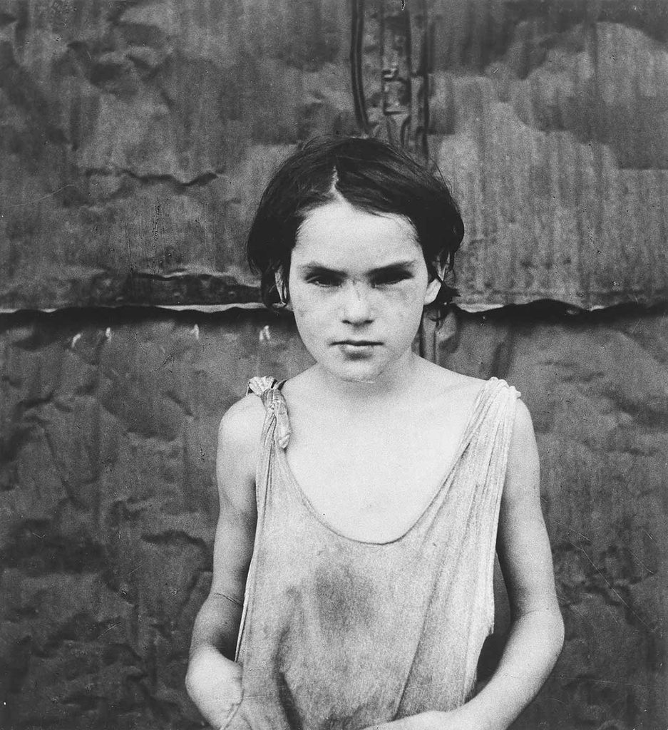 Dorothea Lange Yaralı Çocuk