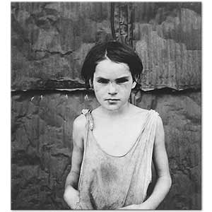 Dorothea Lange Yaralı Çocuk
