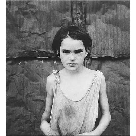 Dorothea Lange Yaralı Çocuk